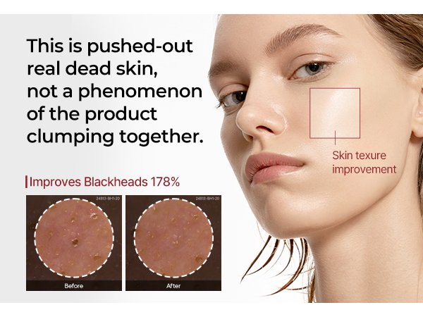 DR.MELAXIN PEEL SHOT LINE Delikatnie złuszczająca ampułka z ekstraktem z białego ryżu 80 ml #7